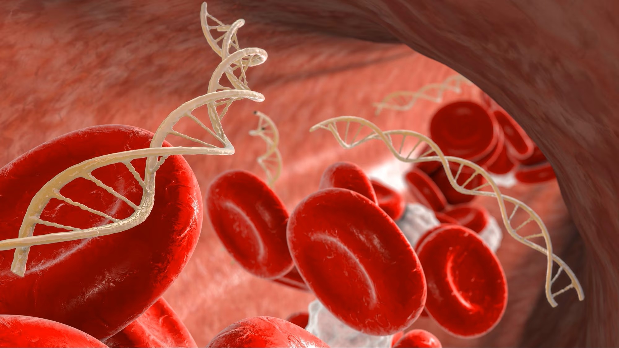 Can tissue-free ctDNA detect breast cancer relapse early?